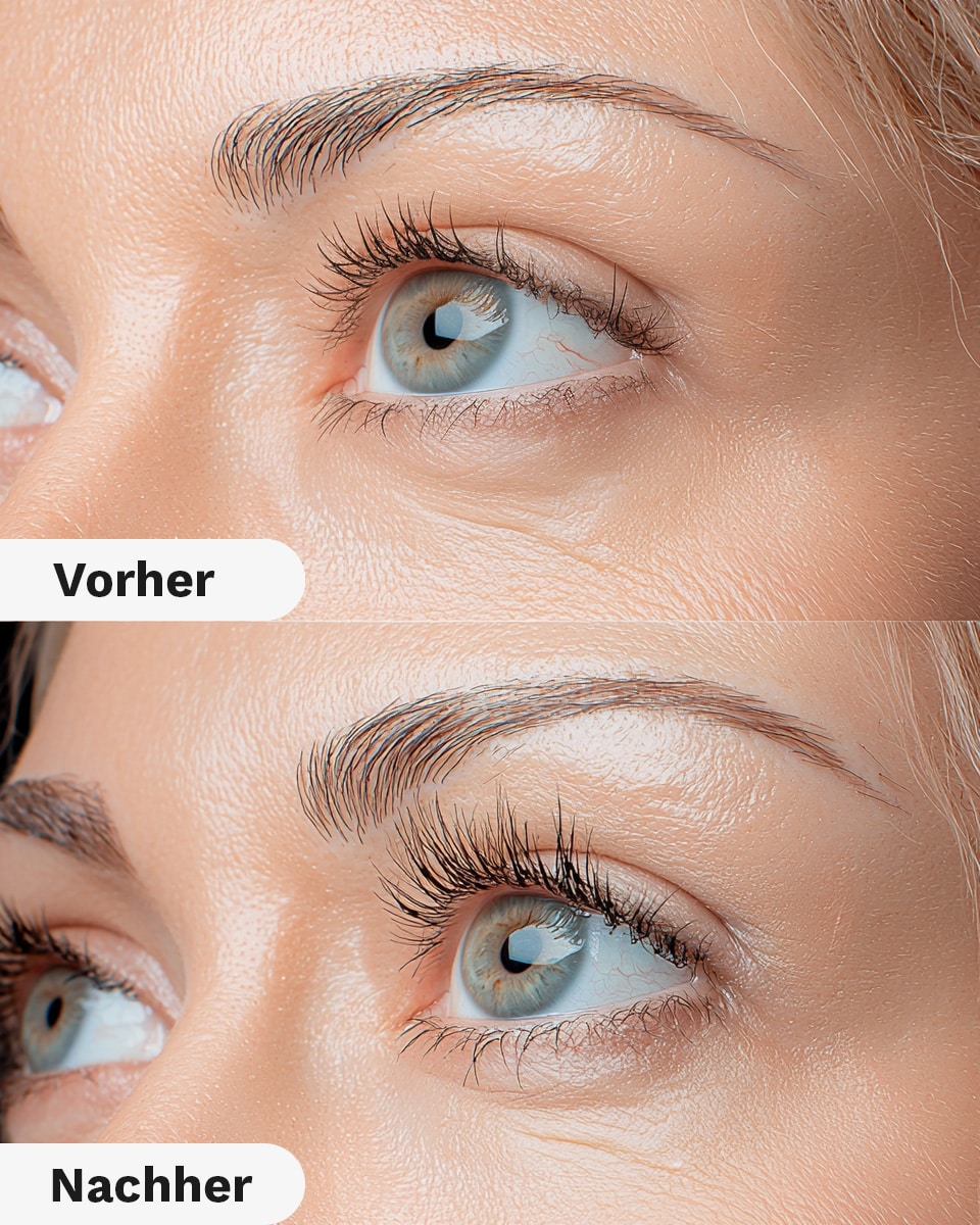 Vorher Nachher The Derma Check What to expect2