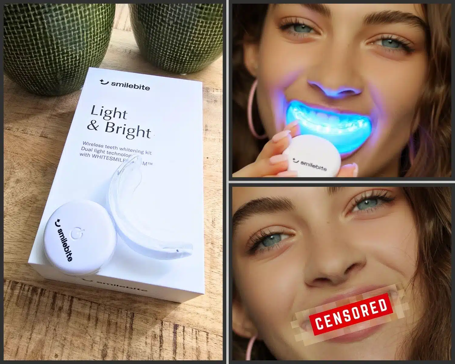 Sophie Laurent Avant Après Smilebite Blanchiment Censuré